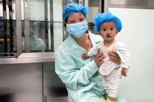 A child ready for surgery - Alliance for Smiles - Mission to XingYi, China