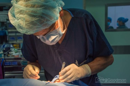 Cleft palate surgery