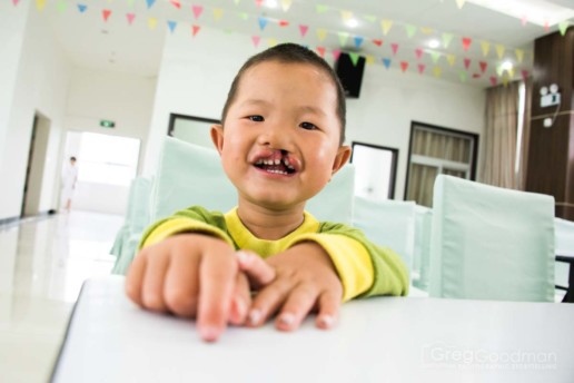 Alliance for Smiles - Mission to XingYi, China