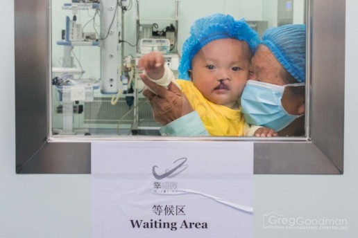 Waiting for cleft palate surgery - Alliance for Smiles - Mission to XingYi, China